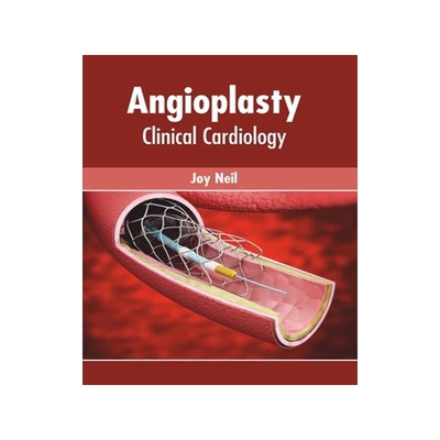[预订]Angioplasty: Clinical Cardiology 9781639270149