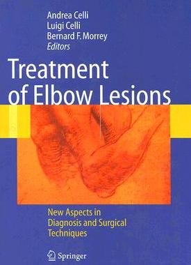 【预订】Treatment of Elbow Lesions