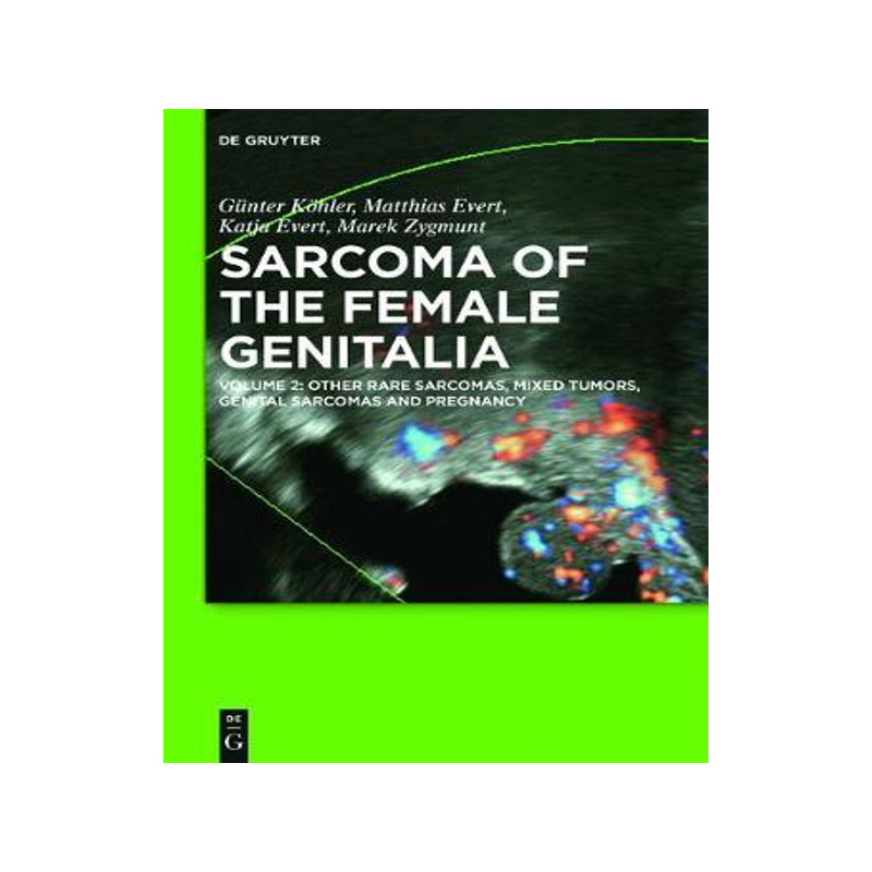 [预订]Other Rare Sarcomas, Mixed Tumors, Genital Sarcomas and Pregnancy 9783110459210