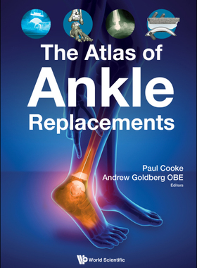 【预订】Atlas of Ankle Replacements, the