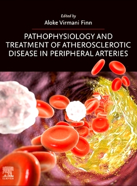 预订 Pathophysiology and Treatment of Atherosclerotic Disease in Peripheral Arteries 外周动脉粥样硬化性疾病的病理生理学
