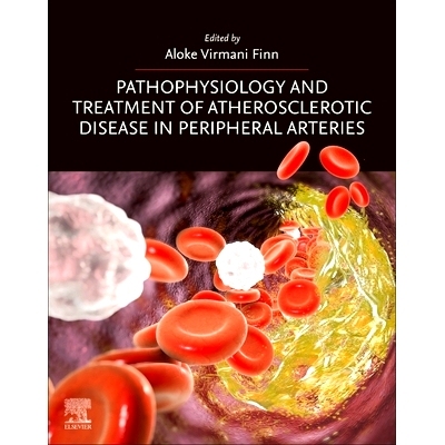 预订 Pathophysiology and Treatment of Atherosclerotic Disease in Peripheral Arteries 外周动脉粥样硬化性疾病的病理生理学