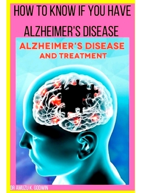 预订 How to know if you have Alzheimers disease: Sign And Symptoms for Alzheimer’s disease: 9798373177719