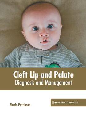 [预订]Cleft Lip and Palate: Diagnosis and Management 9781639871087
