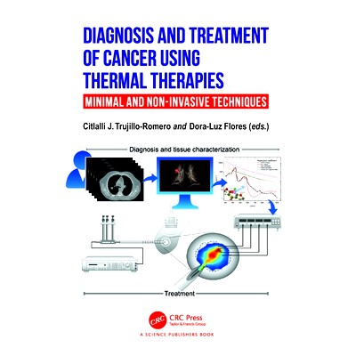 预订 Diagnosis and Treatment of Cancer using Thermal Therapies: Minimal and Non-invasive Techniques 利用热疗法诊断与治疗