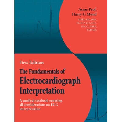 预订 The Fundamentals of Electrocardiograph Interpretation: A medial textbook covering all considerations on ECG interpr