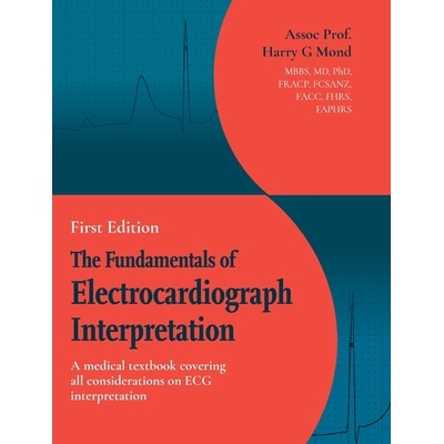 预订 The Fundamentals of Electrocardiograph Interpretation: A medial textbook covering all considerations on ECG interpr