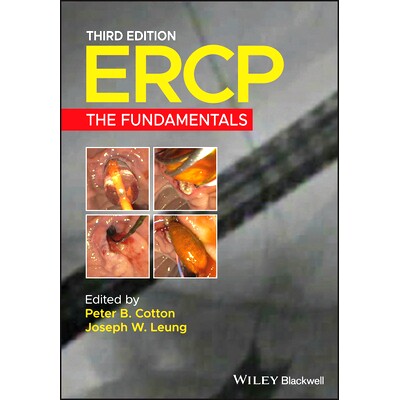 Ercp - the Fundamentals 3E: the Fundamentals 3E 内镜逆行胰胆管造影：基础 第3版: 9781119601098