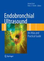预订 Endobronchial Ultrasound
