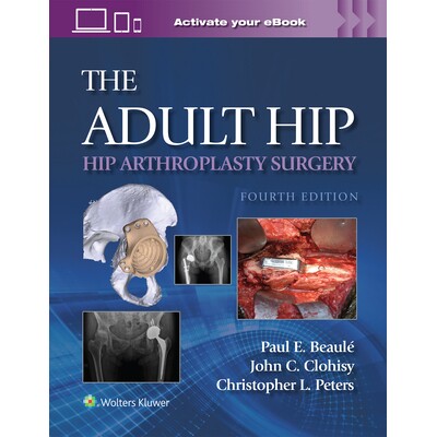 预订 The Adult Hip Hip Arthroplasty Surgery Print + eBook with Multimedia 成人髋关节:髋关节置换手术 9781975221935
