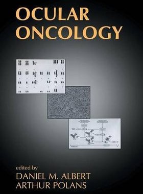 【预订】Ocular Oncology