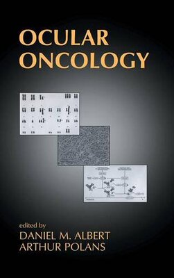 【预订】Ocular Oncology
