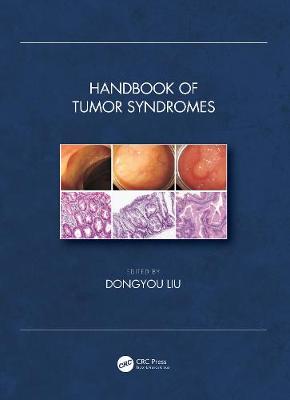【预订】Handbook of Tumor Syndromes