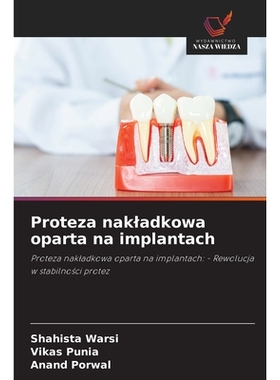 预订 Proteza nakladkowa oparta na implantach: Proteza nakladkowa oparta na implantach: - Rewolucja w stabilnosci protez.