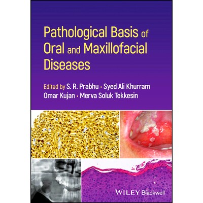 预订 Pathological Basis of Oral and Maxillofacial Diseases 口腔颌面部疾病的病理基础: 9781119989202