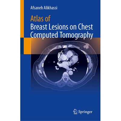 预订 Atlas of Breast Lesions on Chest Computed Tomography 胸部计算机断层扫描乳腺病变图谱 9783032227904