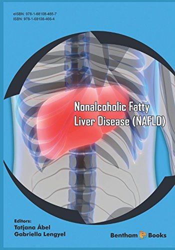 [预订]Nonalcoholic Fatty Liver Disease (NAFLD) 9781681084664