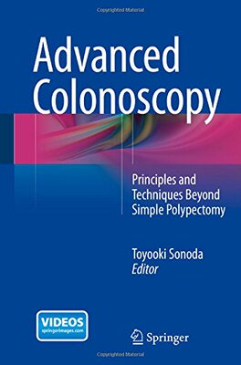 【预订】Advanced Colonoscopy