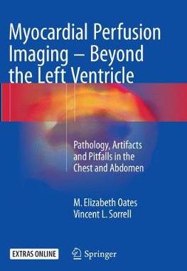 预订 Myocardial Perfusion Imaging - Beyond the Left Ventricle