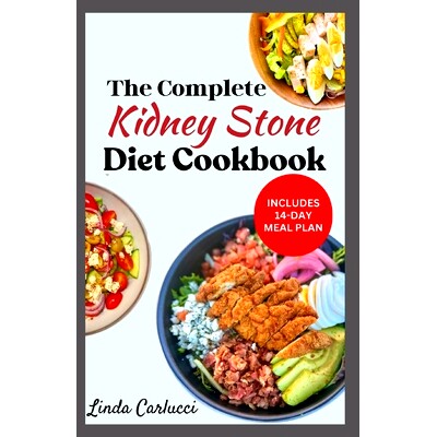 预订 The Complete Kidney Stone Diet Cookbook: Quick Low Cholesterol Low Sodium Low Oxalate Recipes to Manage Inflammatio