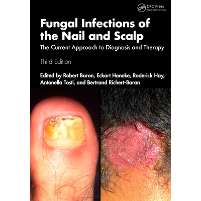 The Current Approach to Diagnosis and Th