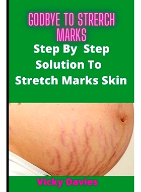 预订 Goodbye To Stretch Marks: Step by Step Solution to Stretch Mark Free Skin: 9798849939667