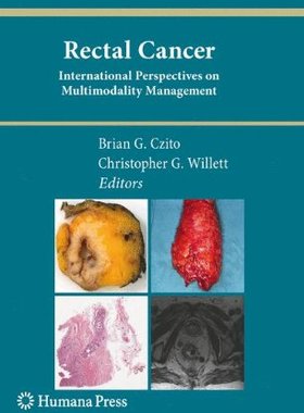 【预订】Rectal Cancer