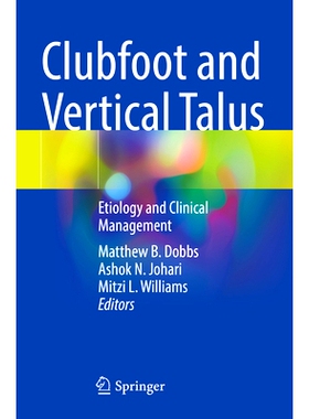 预订 Clubfoot and Vertical Talus: Etiology and Clinical Management 畸形足与垂直距骨：病因及临床处理: 9783031358852