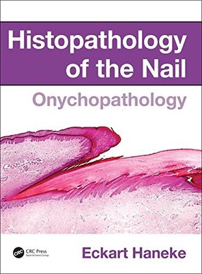 【预订】Histopathology of the Nail