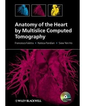预订 Anatomy Of The Heart By Multislice Computed Tomography 通过多层螺旋CT的心脏解剖学: 9781405180559