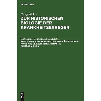 预订 Pott’sche Krankheit an einer ägyptischen Mumie aus der Zeit der 21. Dynastie (um 1000 v. Chr.): 9783111208176
