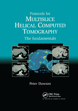 【预订】Protocols for Multislice Helical Computed Tomography: The Fundamentals