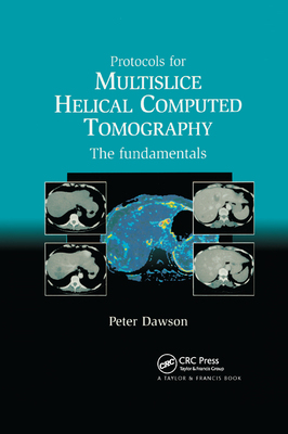 【预订】Protocols for Multislice Helical Computed Tomography: The Fundamentals