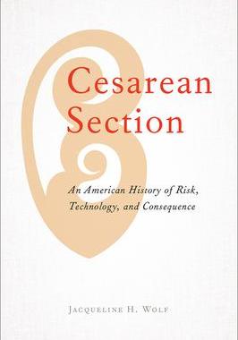 [预订]Cesarean Section: An American History of Risk, Technology, and Consequence 9781421438115