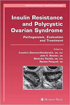 【预订】Insulin Resistance and Polycystic Ovarian Syndrome
