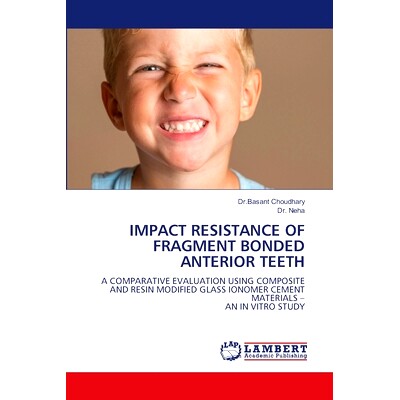 预订 Impact Resistance of Fragment Bonded Anterior Teeth: 9786208224141