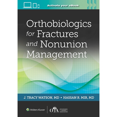 预订 Orthobiologics for Fractures and Nonunion Management 骨折与骨不愈合治疗生物制剂: 9781975182953