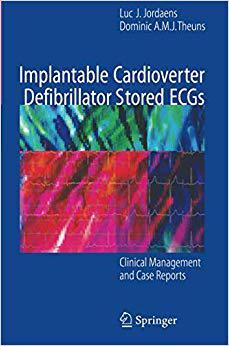 【预订】Implantable Cardioverter Defibrillator Stored ECGs