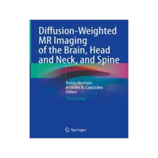 [预订]Diffusion-Weighted MR Imaging of the Brain, Head and Neck, and Spine 9783030621193