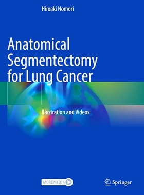 预订 Anatomical Segmentectomy for Lung Cancer: Illustration and Videos: 9789819958597