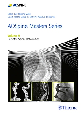 预订 AOSpine Masters Series, Volume 9: Pediatric Spinal Deformities AOSpine 大师系列，第 9 卷：小儿脊柱畸形 xyz: 9781626