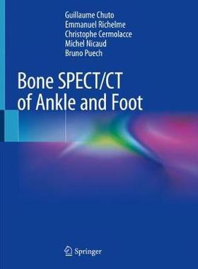 【预订】Bone SPECT/CT of Ankle and Foot
