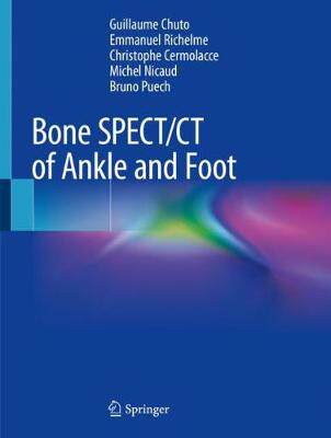 【预订】Bone SPECT/CT of Ankle and Foot