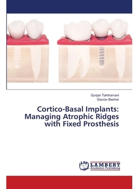 预订 Cortico-Basal Implants: Managing Atrophic Ridges with Fixed Prosthesis: 9786203580983