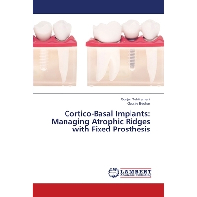 预订 Cortico-Basal Implants: Managing Atrophic Ridges with Fixed Prosthesis: 9786203580983