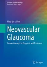 【预订】Neovascular Glaucoma 9783031117190