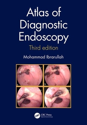 【预订】Atlas of Diagnostic Endoscopy, 3E