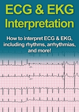 【预订】ECG & EKG Interpretation: How to interpret ECG & EKG, including rhythms, arrhythmias, and more!