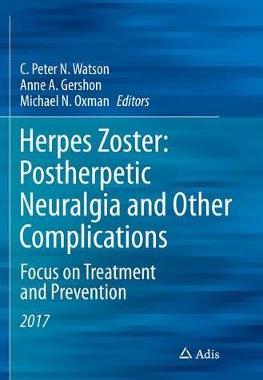 预订 Herpes Zoster: Postherpetic Neuralgia and Other Complications