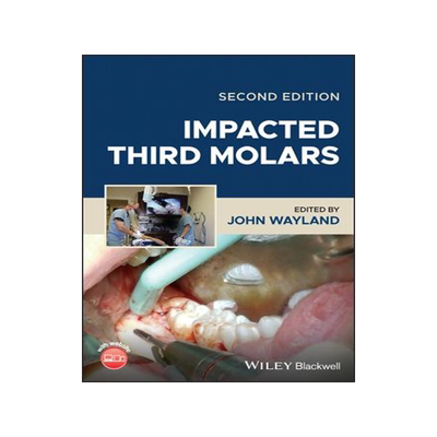 [预订]Impacted Third Molars 9781119930303